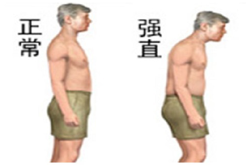 ǿֱԼ׵Ԥղ