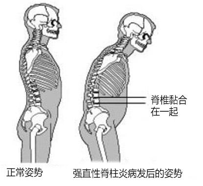 ʲôǿֱԼף.jpg